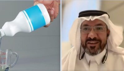 أخصائي يوضح حقيقة علاج عصب الأسنان بالكلور .. فيديو
